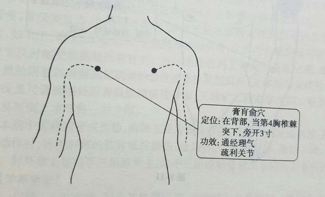 艾灸怎么艾肩周炎