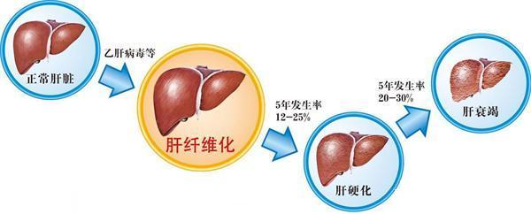 肝衰竭的症状是什么