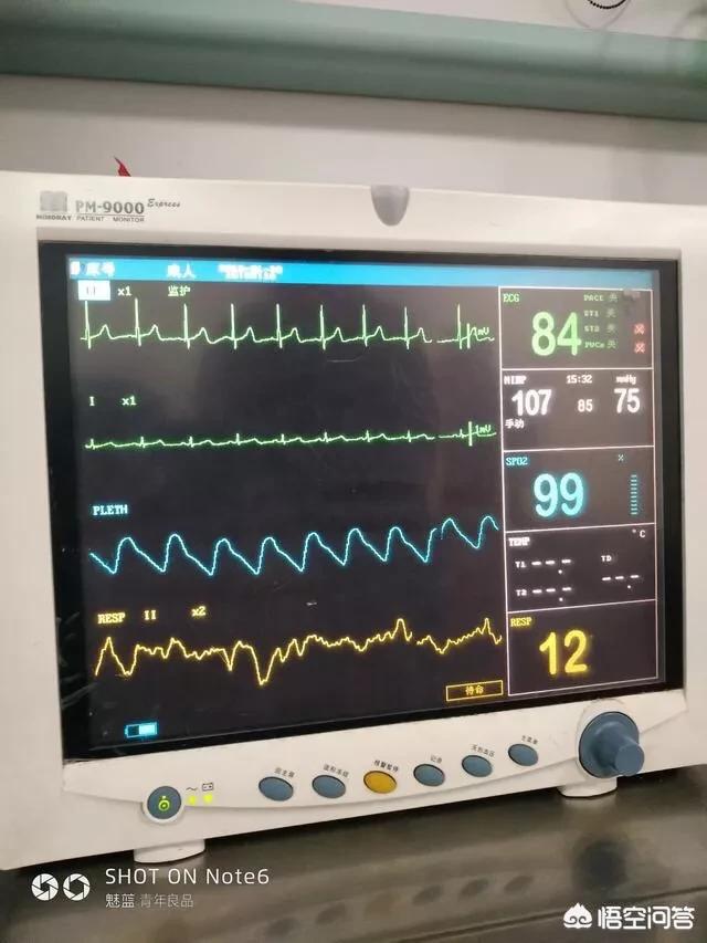 怎样看心电监护仪医院心率机上显实是什么意思