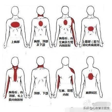 哪些表现提示心肌缺血已经发生哪些表现提示心肌梗死已经敲门心肌缺血