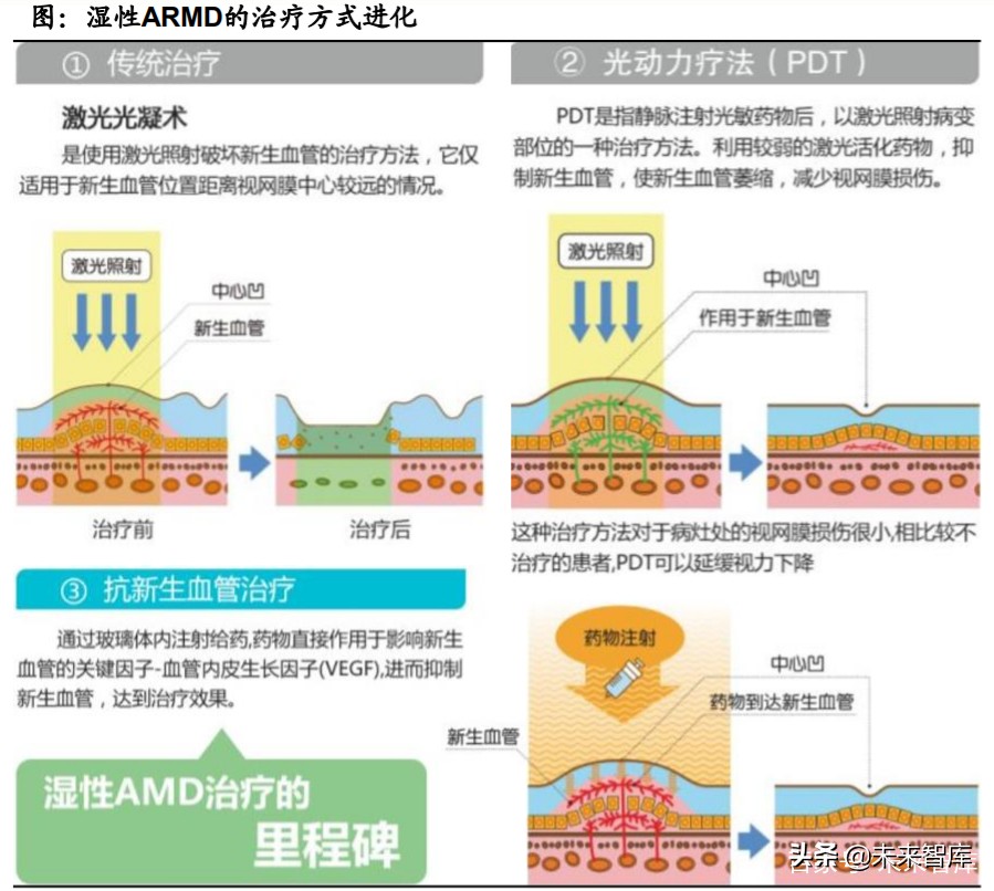 眼科產業鏈深度報告：創新驅動，服務為王