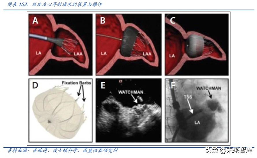 乐普医疗深度解析：布局心血管医疗全产业链，不断创新发展