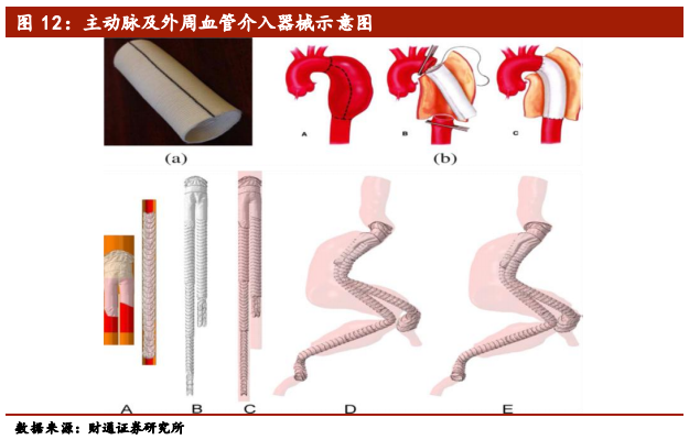 医疗介入器械行业深度报告