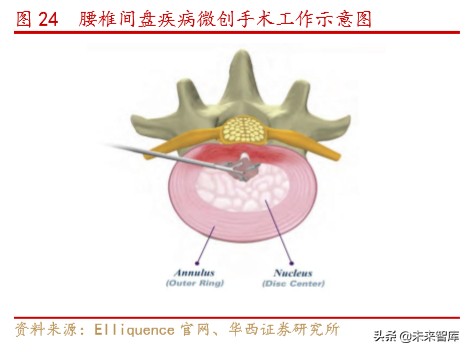 骨科行业深度报告：水大鱼大，老龄化与政策驱动