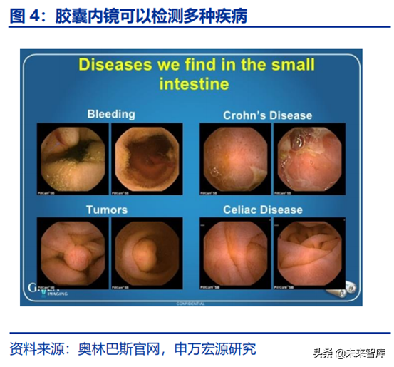 胶囊内镜行业全景分析：行业潜在市场空间巨大
