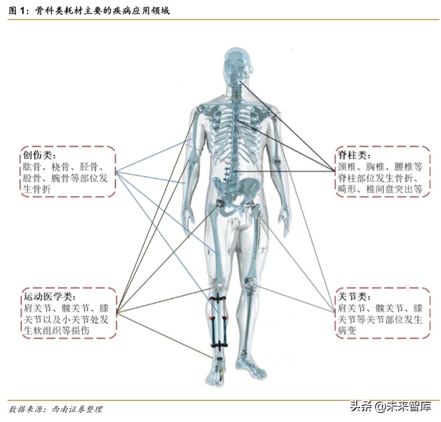 医药行业专题报告之骨科行业深度研究