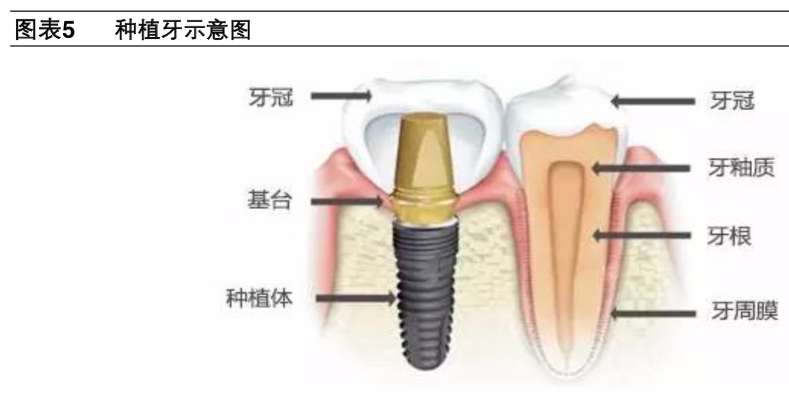 牙科医疗专题报告：种植牙深度研究