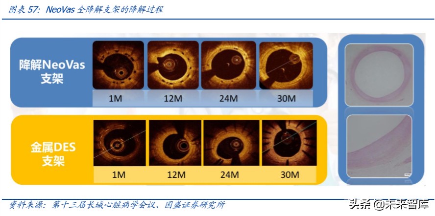 乐普医疗深度解析：布局心血管医疗全产业链，不断创新发展