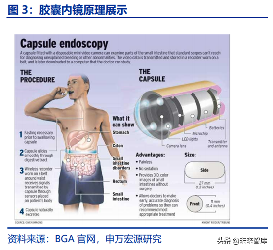 胶囊内镜行业全景分析：行业潜在市场空间巨大