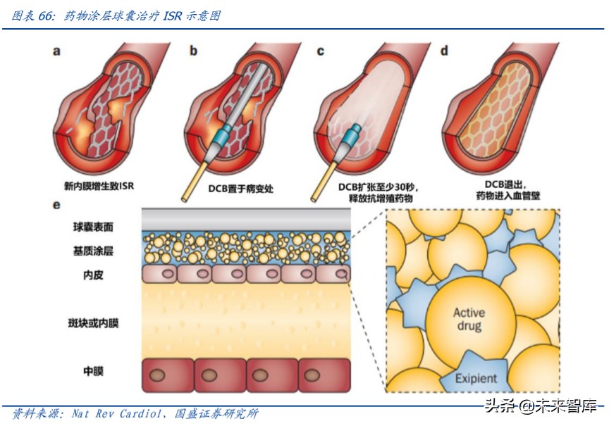 乐普医疗深度解析：布局心血管医疗全产业链，不断创新发展