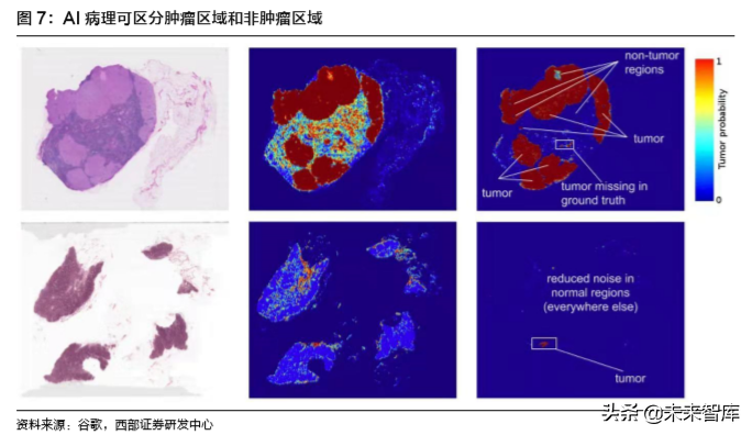 病理检测与诊断行业深度研究报告