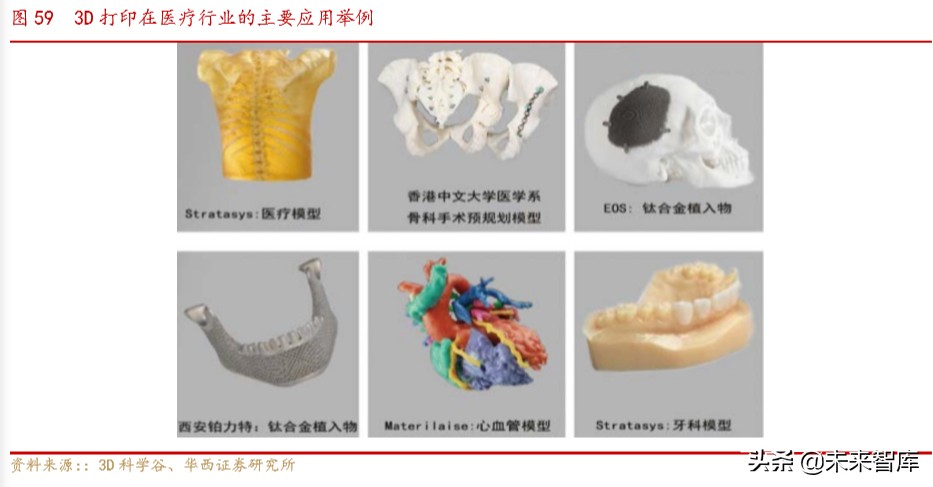 骨科行业深度报告：水大鱼大，老龄化与政策驱动