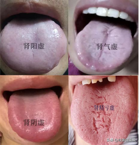 肾虚最应该知道9个信号(肾虚看这里你就会区分了，对症才能事半功倍！)