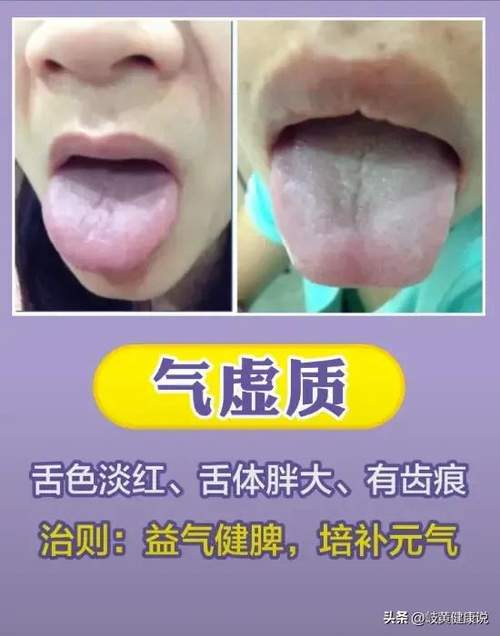 中医怎么判断一个人是什么体质(你还不知道自己是什么体质吗？中医九个体质分类来了)