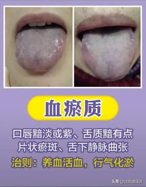 中医怎么判断一个人是什么体质(你还不知道自己是什么体质吗？中医九个体质分类来了)