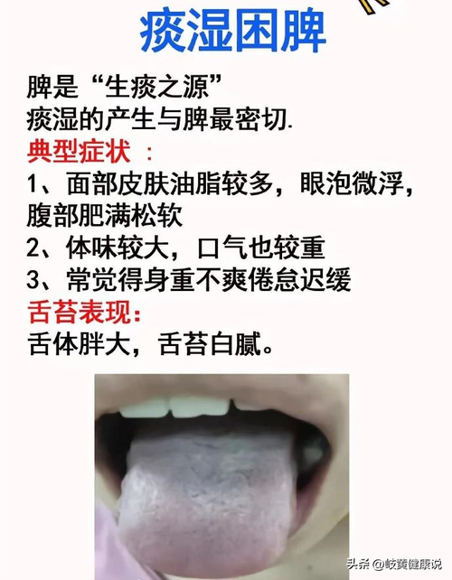 哪些是脾虚的信号(这些脾虚信号，希望你一个都没有。)
