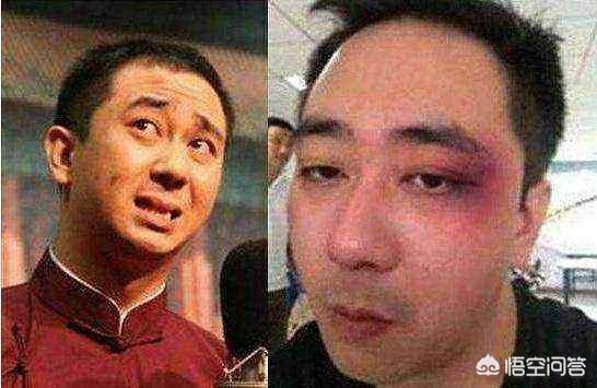 王自健老婆的照片:王自健被妻子家暴并转移财产，他是第一个被家暴的男星吧？
