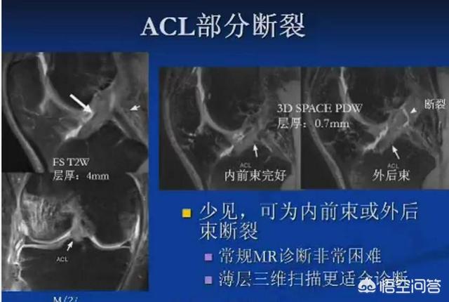 狗狗十字韧带断裂表现:前交叉韧带断裂有哪些症状呢？