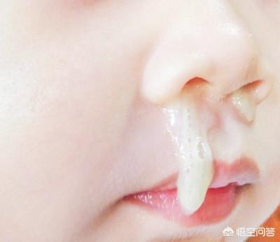 4个月宝宝流鼻涕的原因:4月宝宝感冒鼻塞流鼻涕，吃什么药好呢？