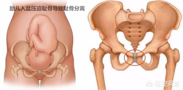 臀位生孩子前的征兆:臀位快生了的征兆 孕晚期最晚第几周去医院看胎位，现在疫情严峻，不敢出门？