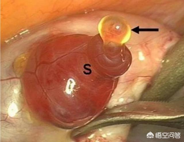 备孕基础体温低于36度:37.5度对快要临产的孕妇小孩有影响吗？