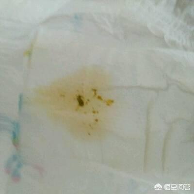 屎尿片:屎尿片属于什么垃圾 新生儿每次换尿布都有点屎，怎么回事？