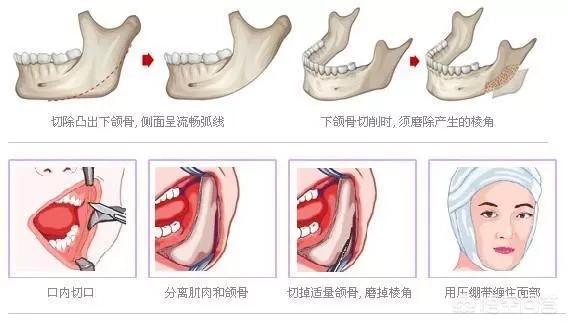 李多海电视剧:李多海在韩国是靠整容出名的吗？