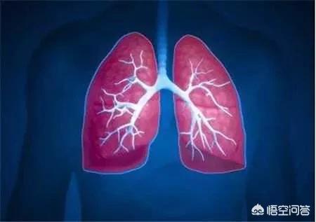 3个恶性肺结节:两肺都有恶性结节怎么办？