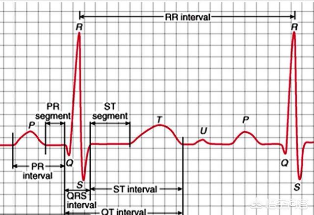 心率变异性怎么解读，“窦性心律不齐”是心脏病吗？