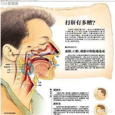 晚上睡觉打鼾怎么办：晚上睡觉打鼾有什么办法可以解决