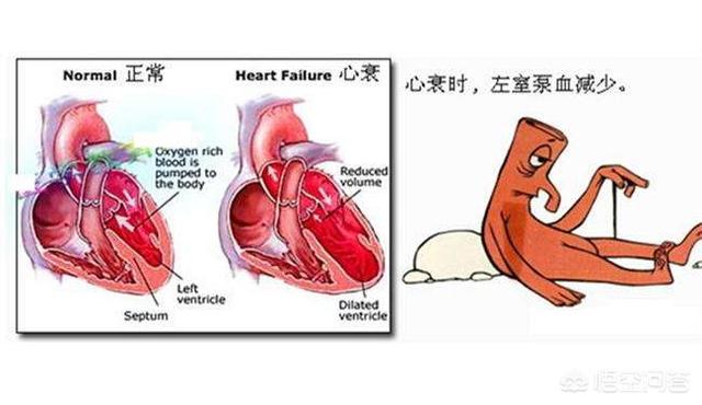 十种不会疼的死亡:急性心肌梗死亡的过程痛苦吗？