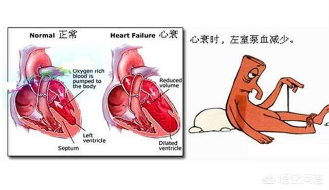 死者死亡过程非常痛苦，急性心肌梗死亡的过程痛苦吗