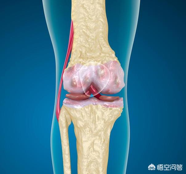 深蹲的标准动作视频,史密斯深蹲，脚放在什么位置？