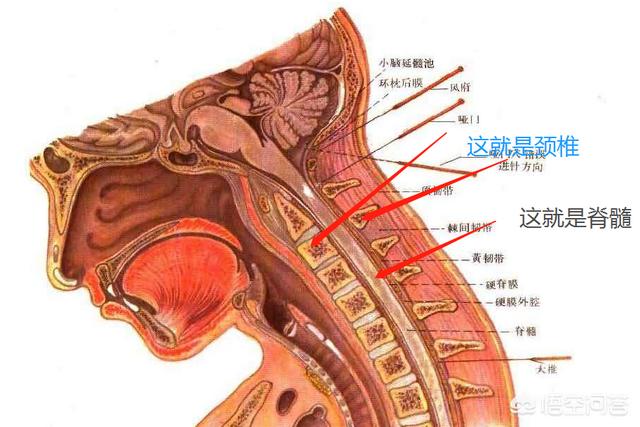 颈神经根炎的症状与治疗:神经根炎是什么病，可以治好吗？