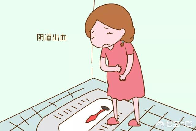 头条问答 怀孕6周 做完b超的第二天出血了 孩子能保住吗 49个回答