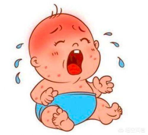 宝宝三个月大，发现身上有湿疹，一热身上就起红点，应该怎么办？