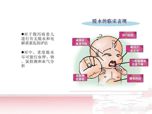 孩子急性胃肠炎的症状及治疗:急性肠胃炎怎么吃能恢复快？ 急性胃肠炎的症状怎么治疗