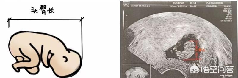 初怀孕多久能做b超:怀孕多久做产检最好 如何根据早期B超计算孕周？