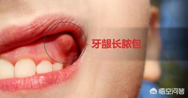 育儿网