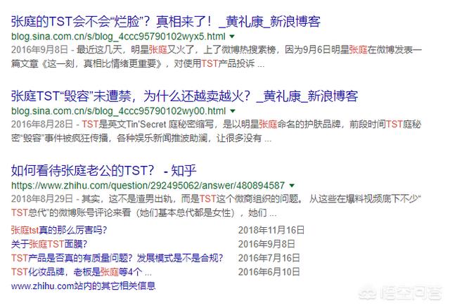 张庭的老公是谁:如何看待张庭的老公被人说像老奶奶？