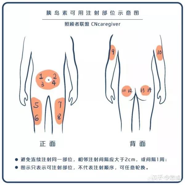 头条问答 - 胰岛素对治疗糖尿病非常重要,怎么才是正确的打法?