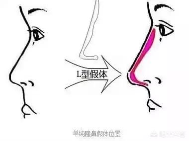李多海电视剧:李多海在韩国是靠整容出名的吗？