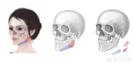 李多海电视剧:李多海在韩国是靠整容出名的吗？