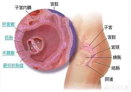孕囊位于子宫中段影响大不大?孕囊位于宫腔中段在哪个位置