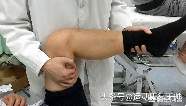 前交叉韧带断裂术后锻炼:交叉韧带断裂术后怎样减轻屈伸练习的疼痛？