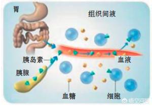 饭后可以打胰岛素吗，为什么？