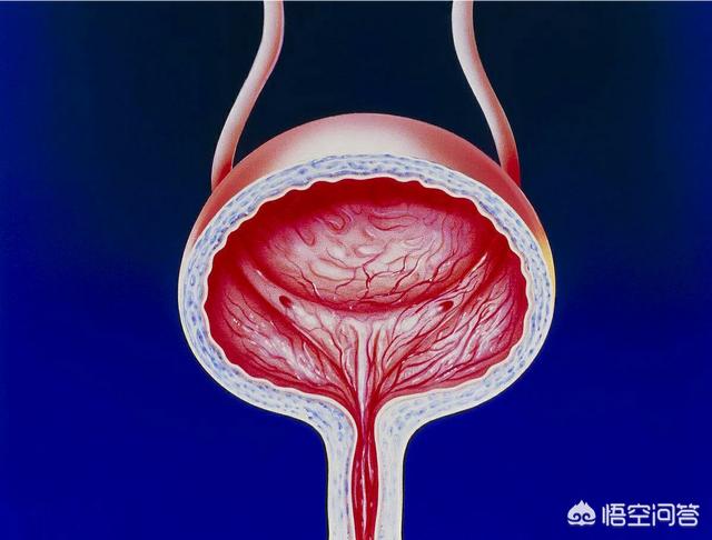 膀胱炎的症状有哪些膀胱炎的症状有哪些