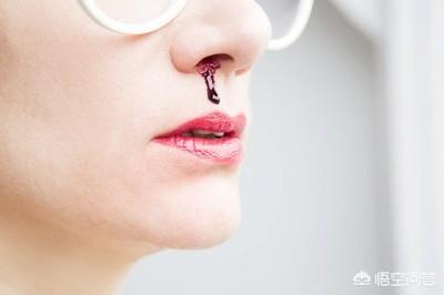 流鼻血时怎么办?该如何预防?