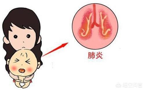 新生儿肺炎严重吗:新生儿肺炎严重吗一般要多久才好 新生儿肺炎住院12天，出院后孩子还咳嗽，这正常吗？