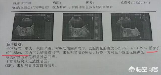 预产期怎么算最准(预产期怎么算才最准确)